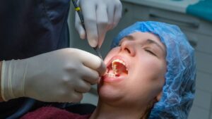 Dental Abscess Symptoms and Treatment: Don’t Wait